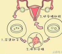 濮阳做第三代试管婴儿的价格是多少呢？